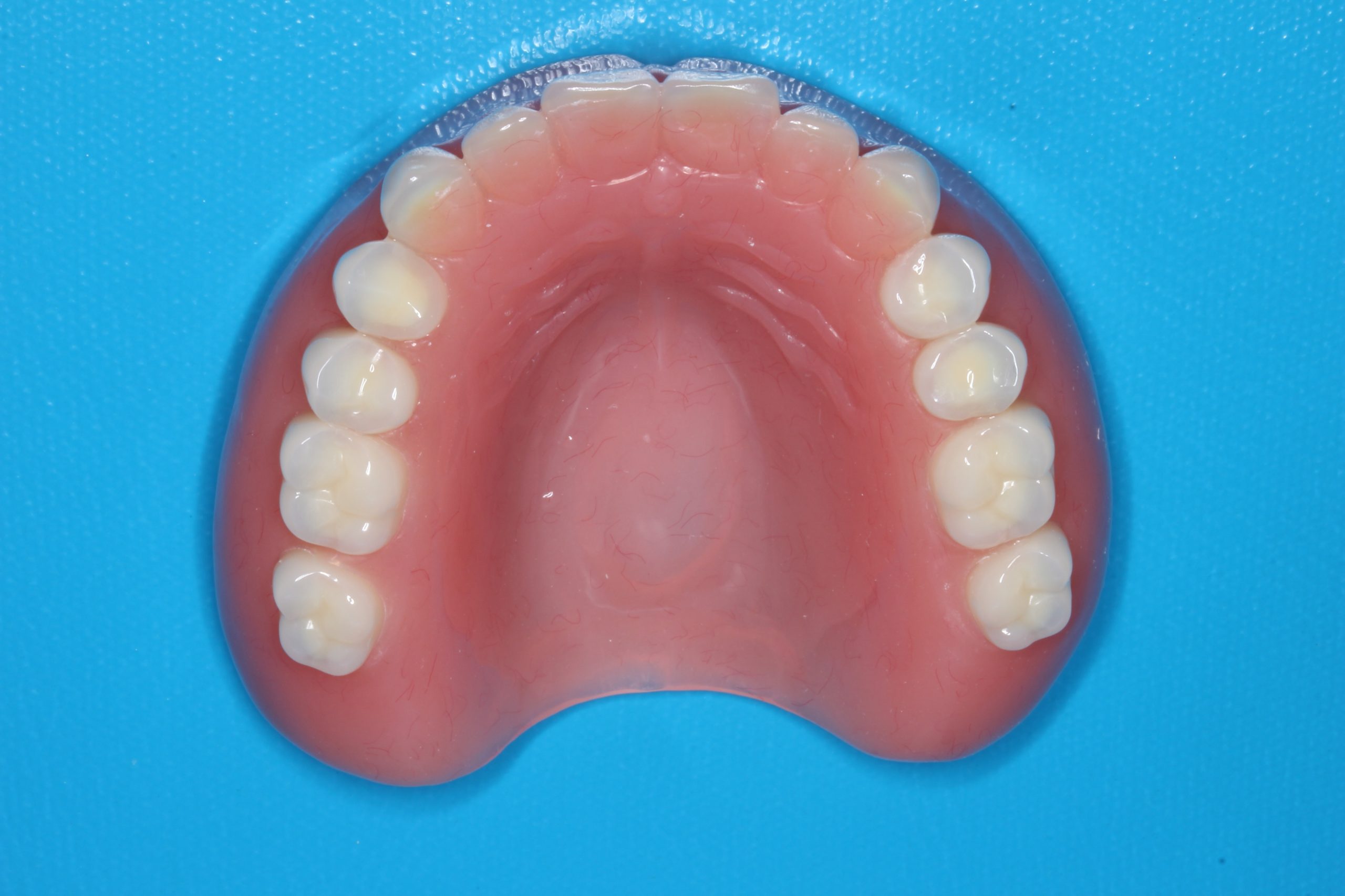 完成した総入れ歯